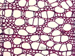 Aesculus glabra, Cross-Section